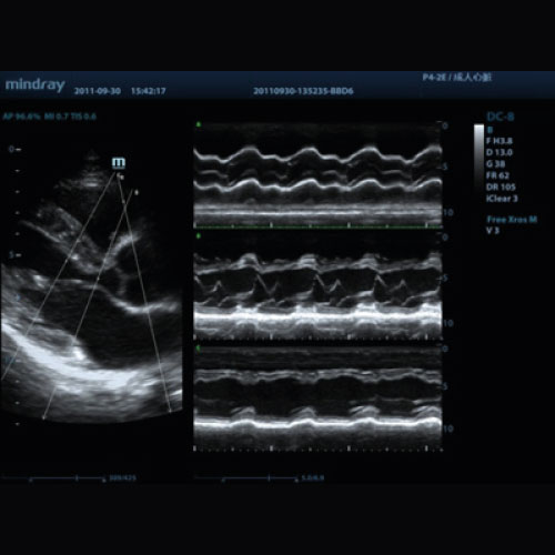Free Xros M (Anatomischer M-Modus)