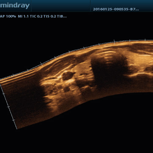 [VETUS5013] iScape View (Imagerie panoramique en temps réel)