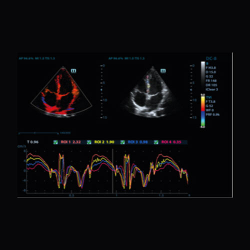 [VETUS5019] Analyse de quantification TDI