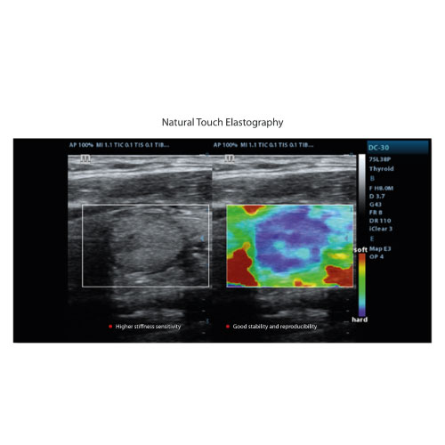 [VETUS5020] Natural Touch Elastography